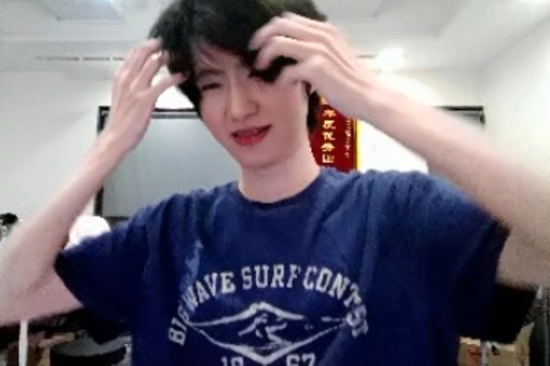 小宝怎么皱巴巴的 
