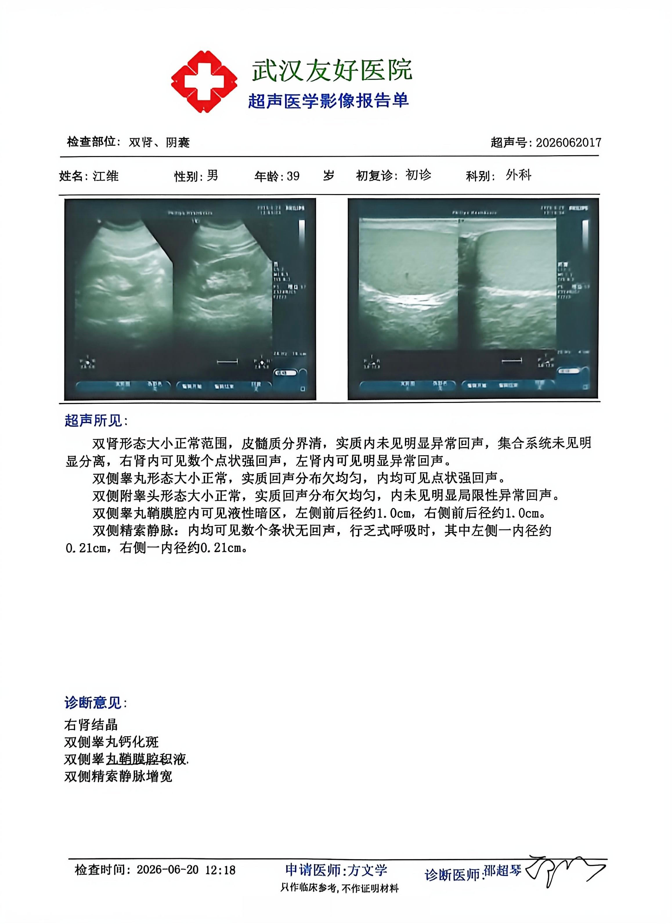 武汉友好医院男性多普勒超声检查报告单 