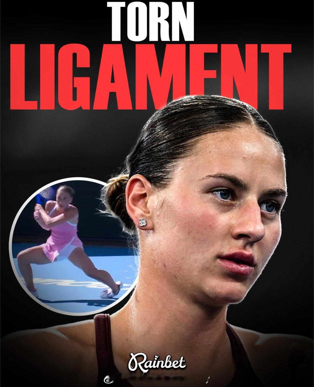 科斯秋克确认韧带拉伤科斯秋克：“很遗憾，我在今天的比赛中脚踝受伤，后续检查确认了