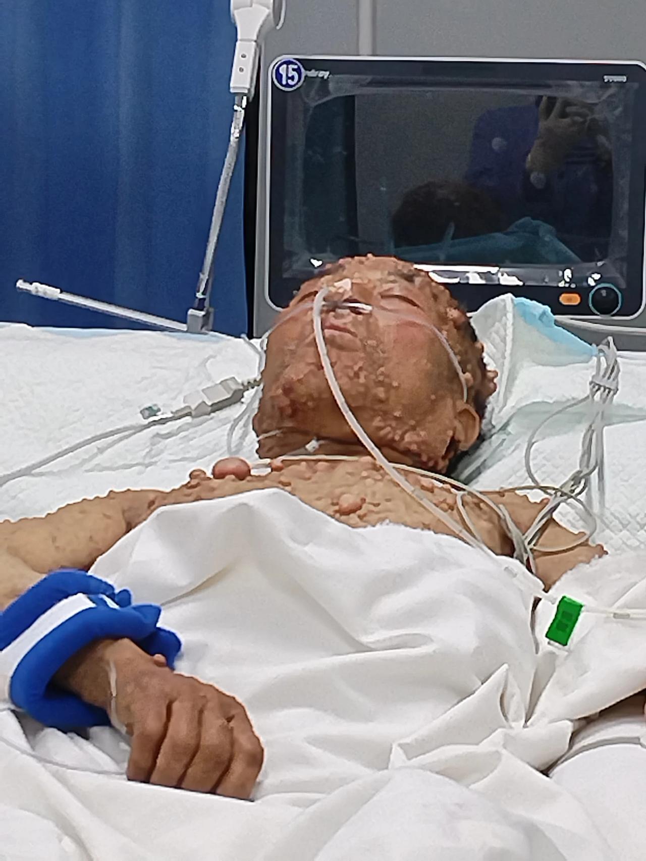 来个真实的，我在重症监护室看到的。