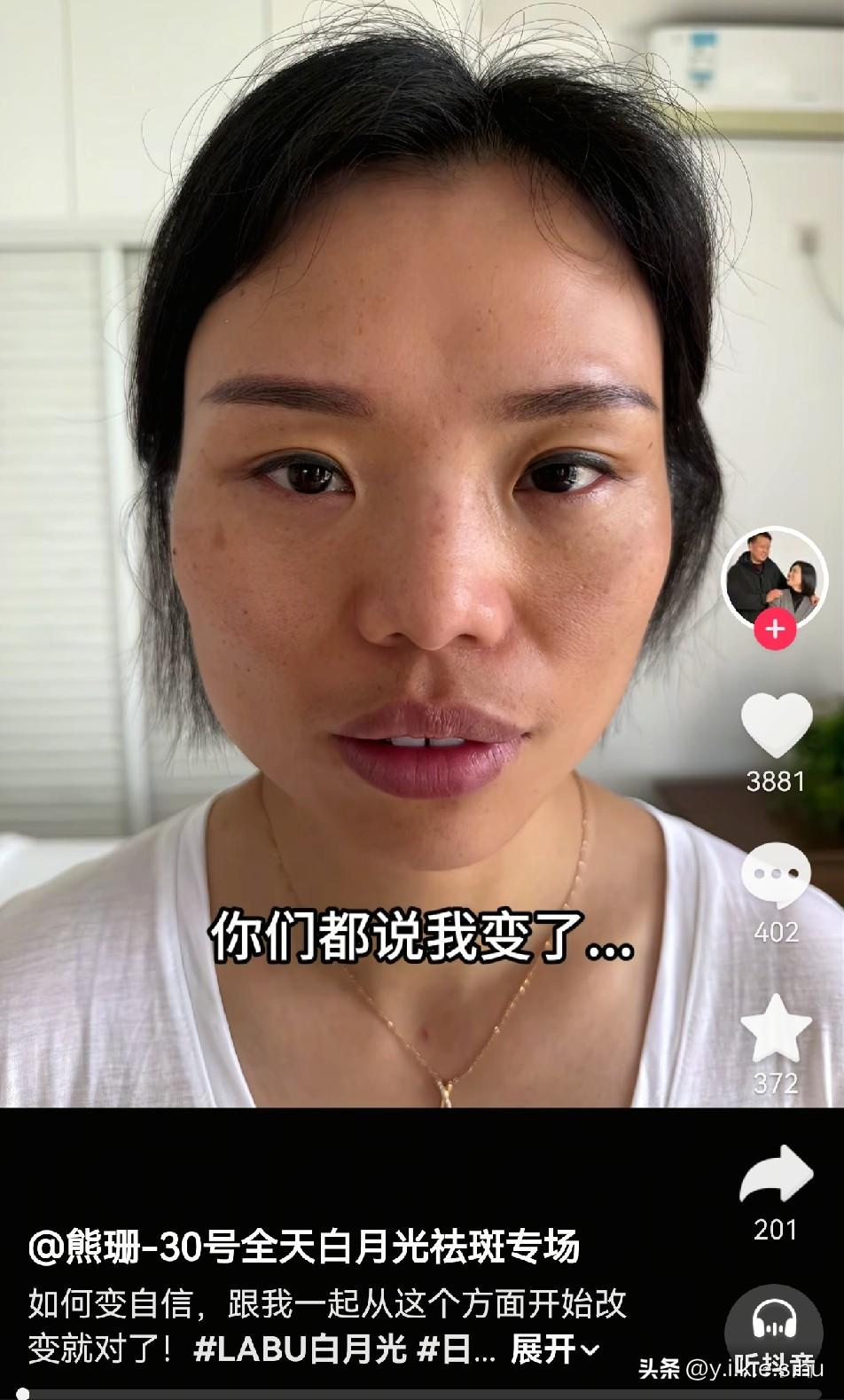 熊珊最近一直晒丑照并承认医美，原来是要准备直播卖产品了