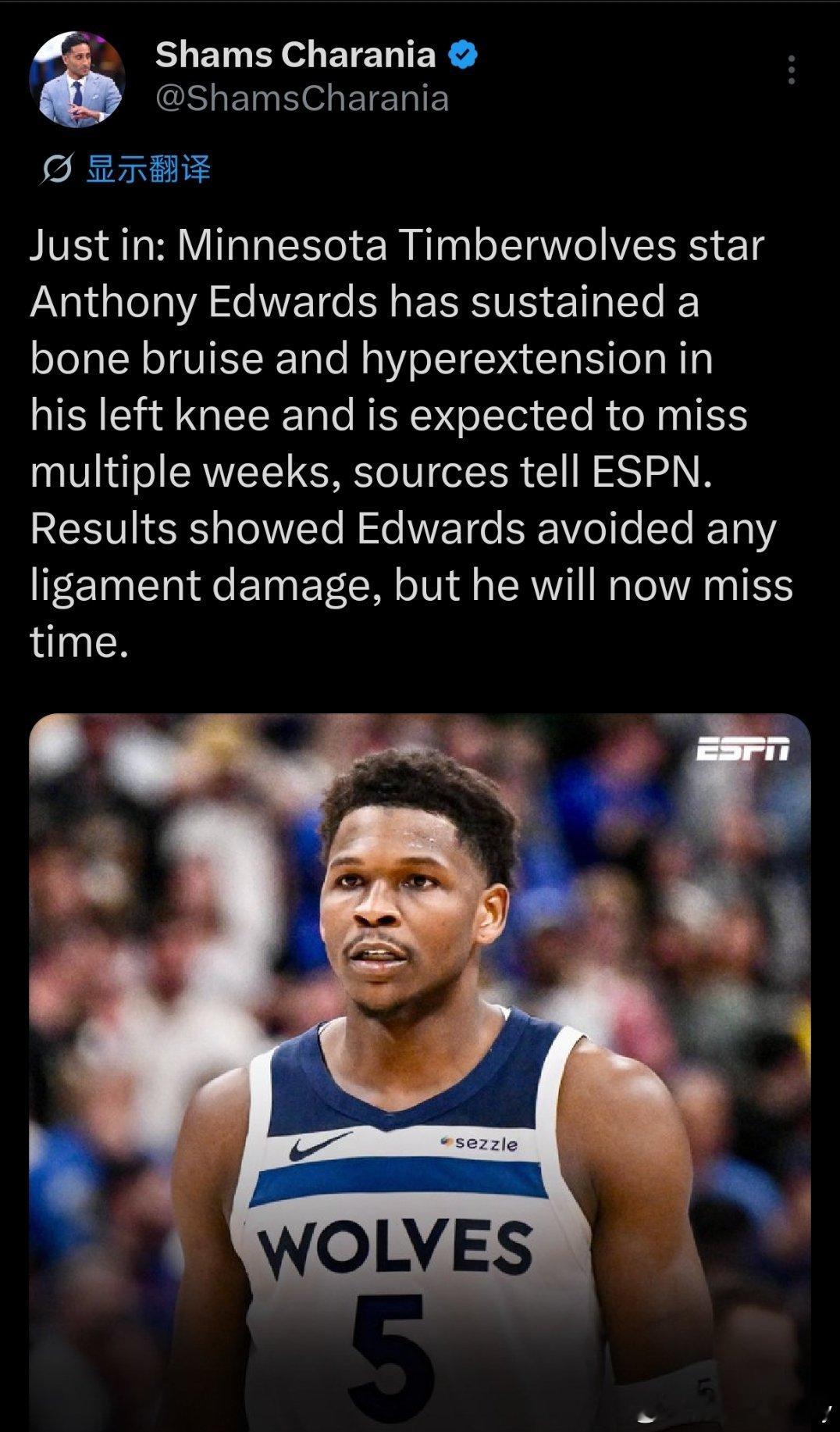 Shams：爱德华兹左膝遭遇骨挫伤及过度伸展，预计将缺席数周。检查结果显示，爱德