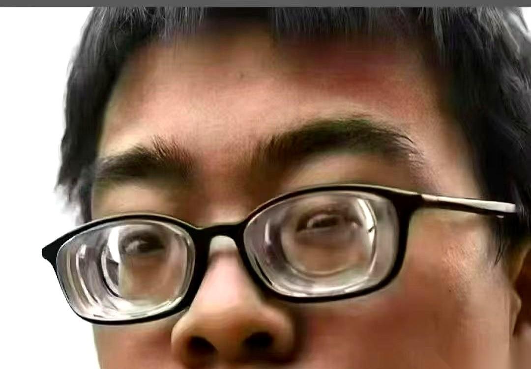 我一直以为，那些戴着一千度近视眼镜的人，老了眼睛就彻底废了。
结果前几天家庭聚会