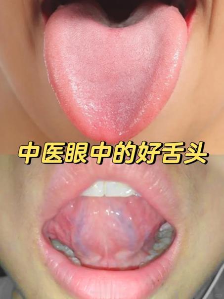 分析这么多舌象了，很多人都问：什么才是正常健康的舌头？
今天我就给大家分享一个，