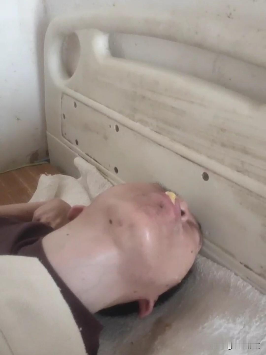 真泪目！一辈子就因为小时候打错针而毁了！从8岁那年起就瘫痪在床上，无法自理，平时