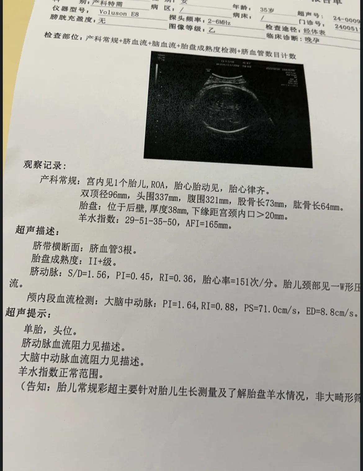 我的宝藏兴趣我们家里要添小新成员了，心里很激动，为了家庭兴旺，辛苦了好长时间，自