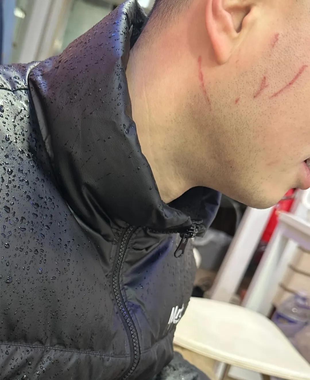 哥们儿说是猫挠的，可我瞧着不太像，嫂子那么温柔的人...