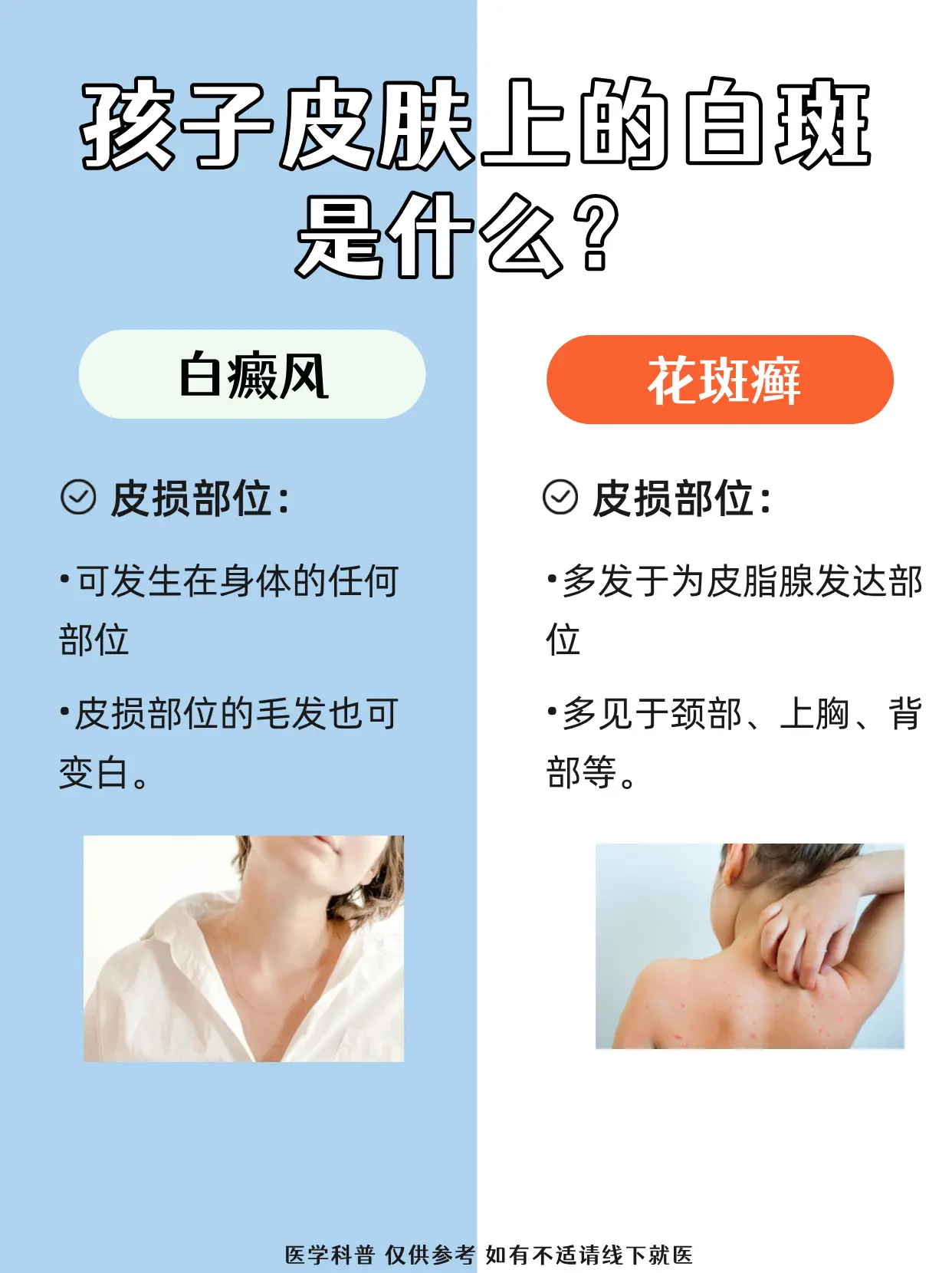 孩子身上的白斑，别搞错了