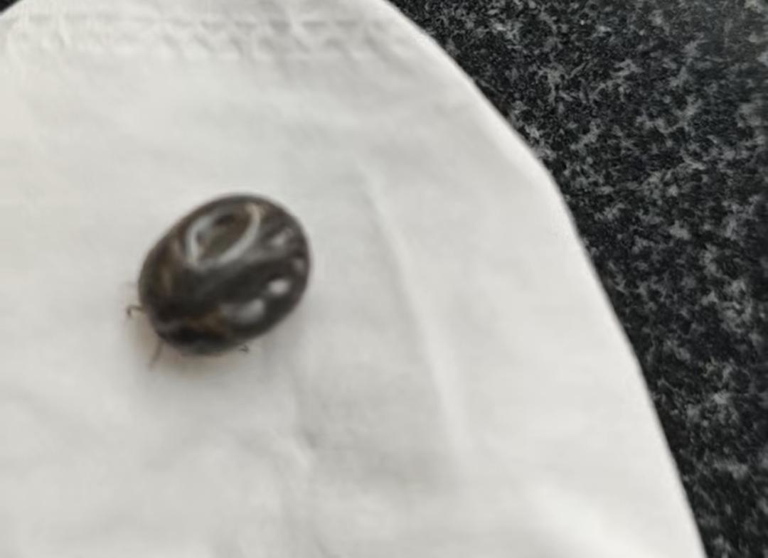 “今天一上午就收治了好几个被蜱虫叮咬的患者。”4月3日，武汉大学中南医院感染科主