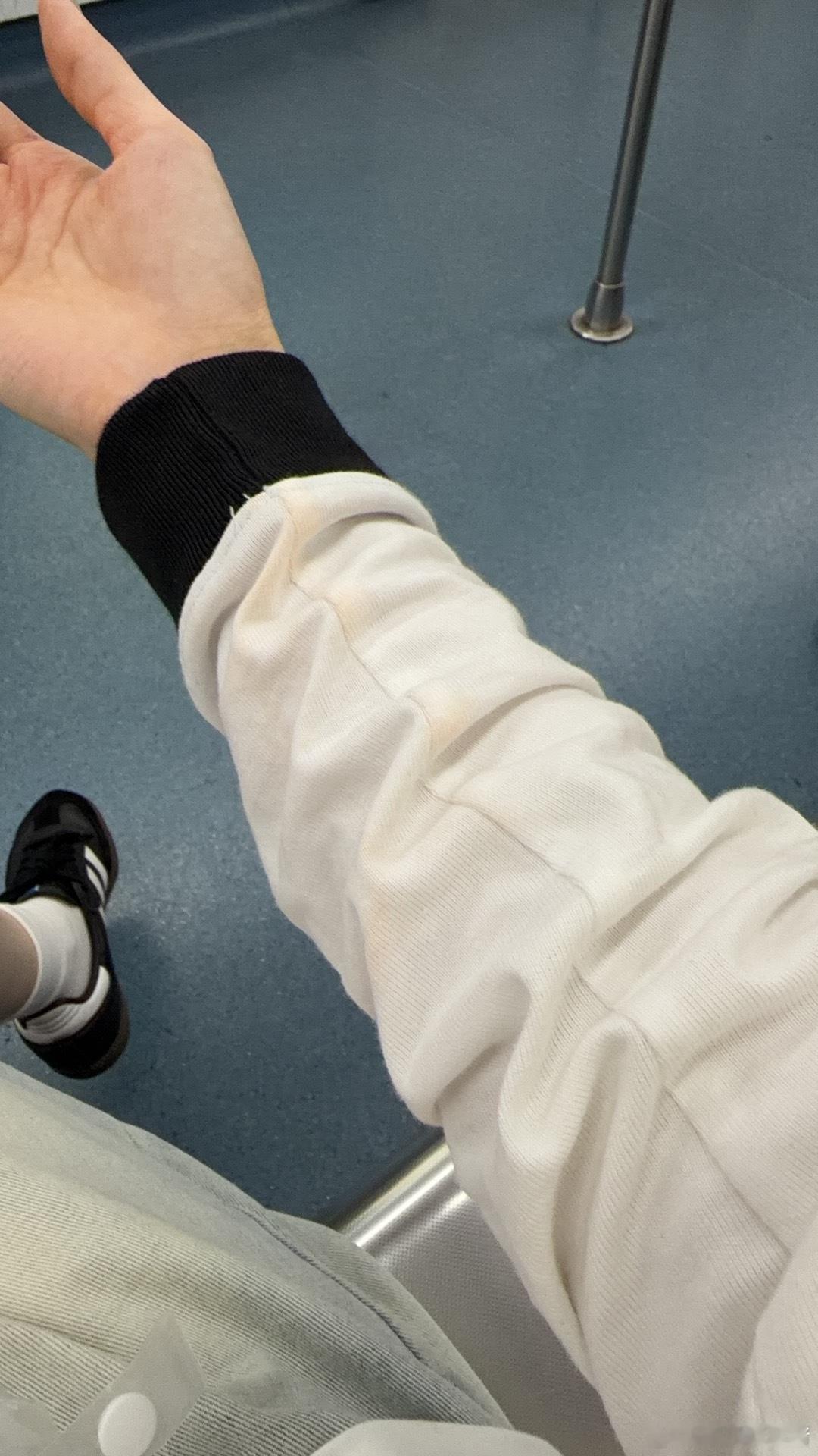 第一天穿的新衣就这样受工伤