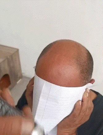 这是多此一举啊，还不如秃顶好看啊！