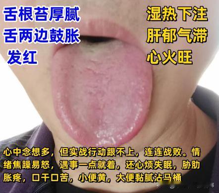 今日舌诊案例分析，你来发，我来看[微笑][微笑][微笑]