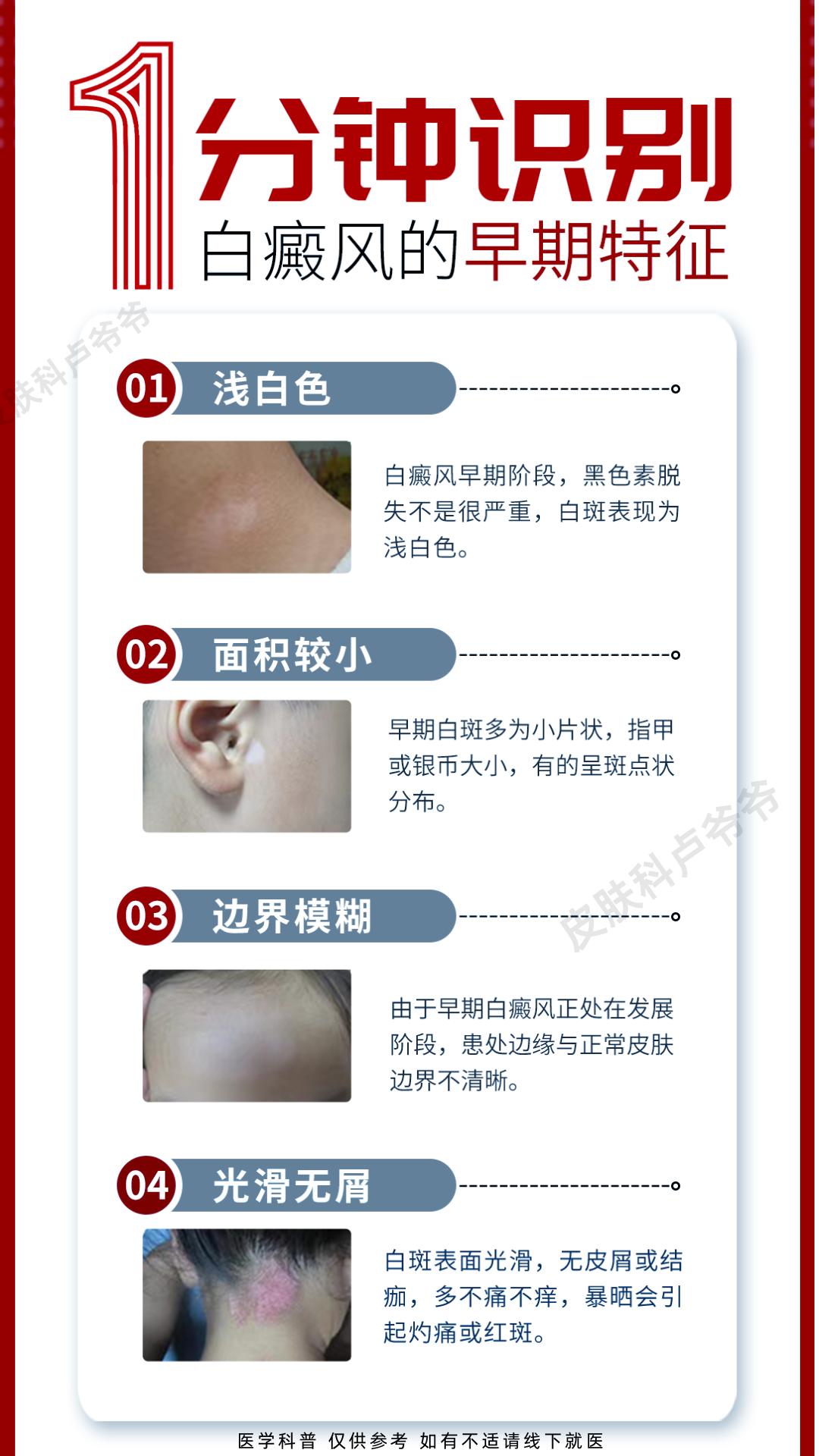 教你4步，辨别白癜风