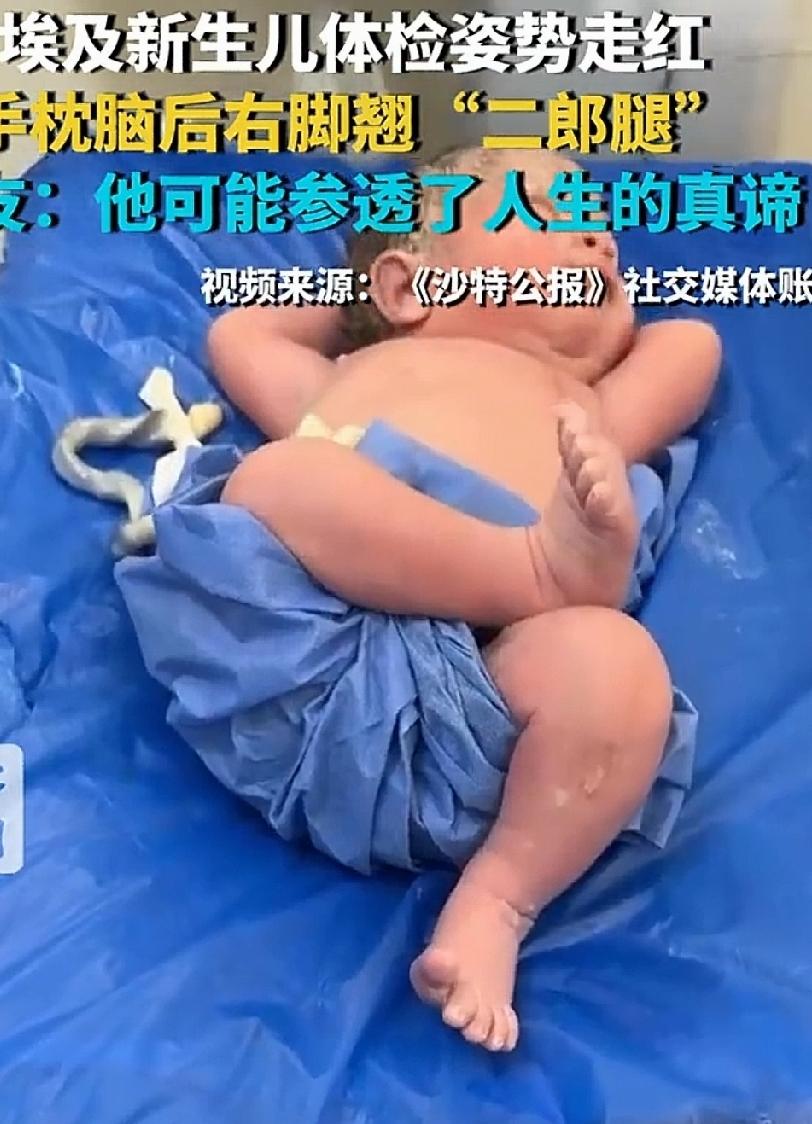 埃及一名刚出生的新生儿，在检查台接受体检的姿势非常有趣。
人们常见的新生儿降临人