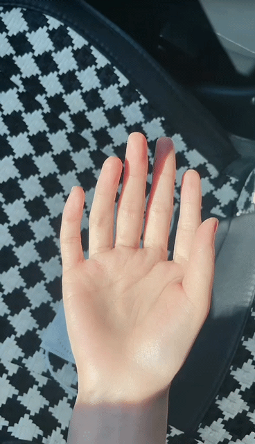 六指的手能这么和谐不多见，多数六指多出的那一根是畸形~ ​​​