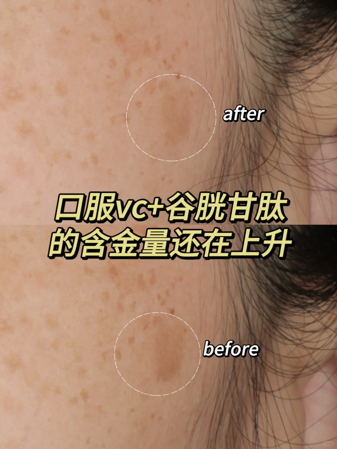 美白只是它的强项之一 淡斑才是它的舒适区