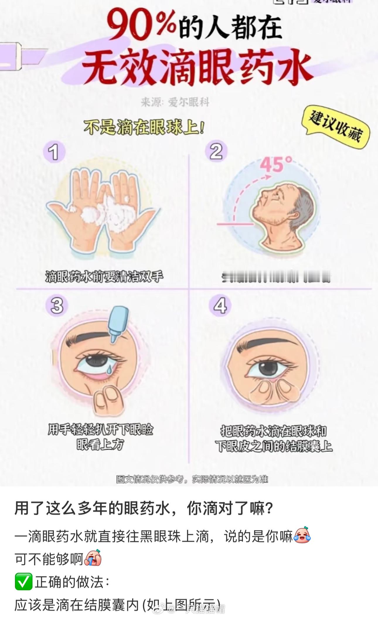 [跪了]原来我真不会滴眼药水！又学到了谢谢好心网友 
