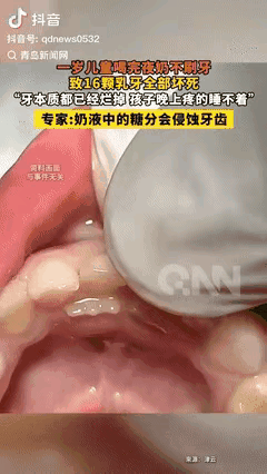 “太大意了！”9月24日报道，杭州1岁多的小孩经常哭闹不睡觉，去医院检查后才发现