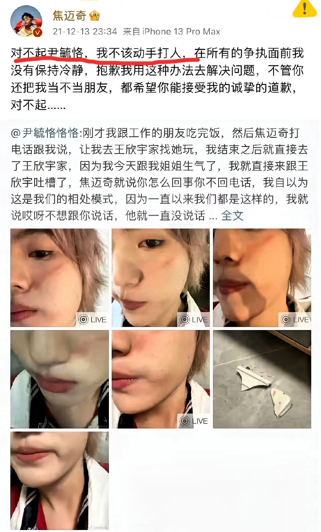 焦迈奇旧闻被扒：
时间不是污点的“橡皮擦”
 网友的“考古”能力永远让人惊叹！