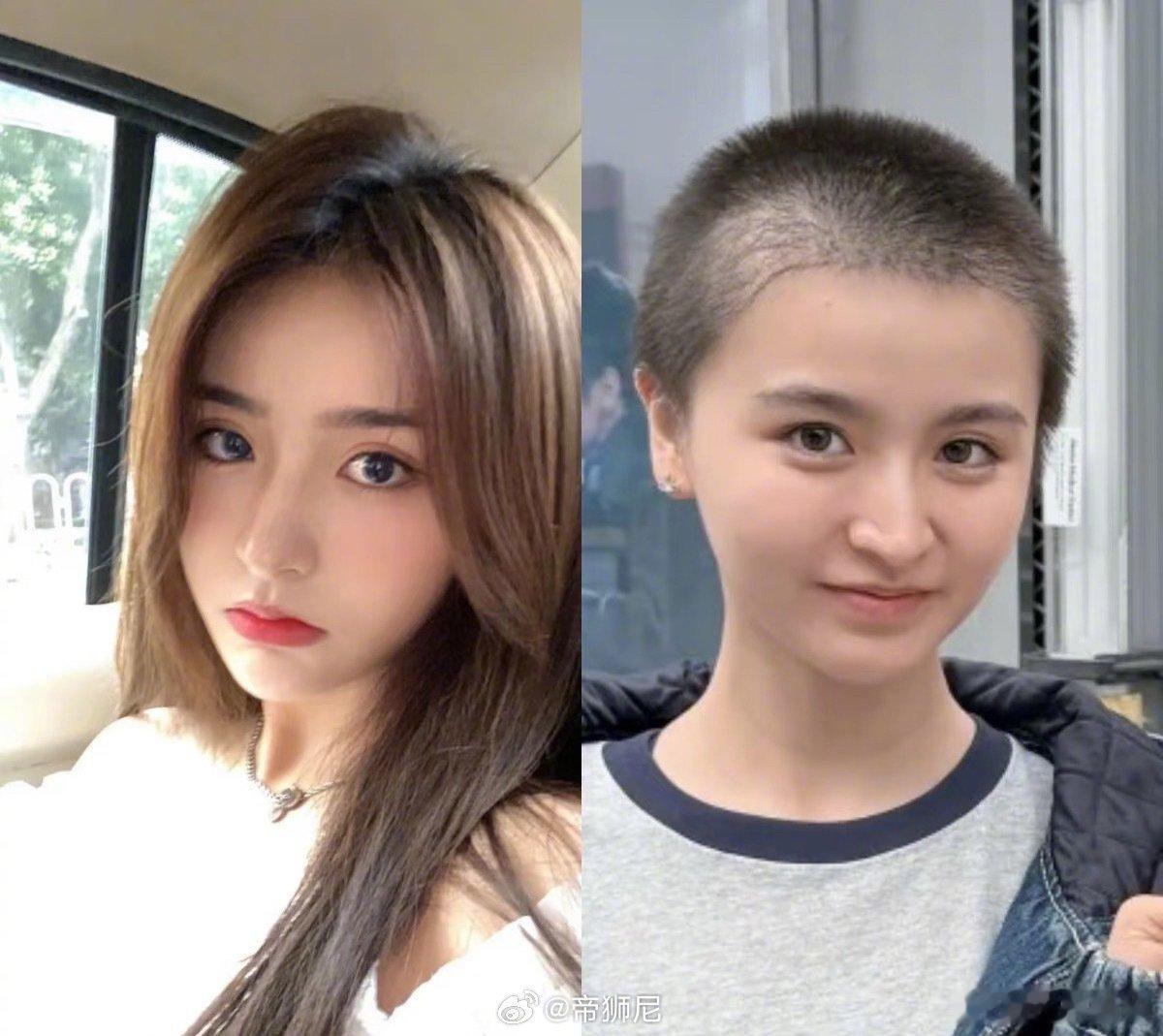 天呢，一百多帧这也太吓人了吧……金子涵称脸上被打了100多针 ​​​