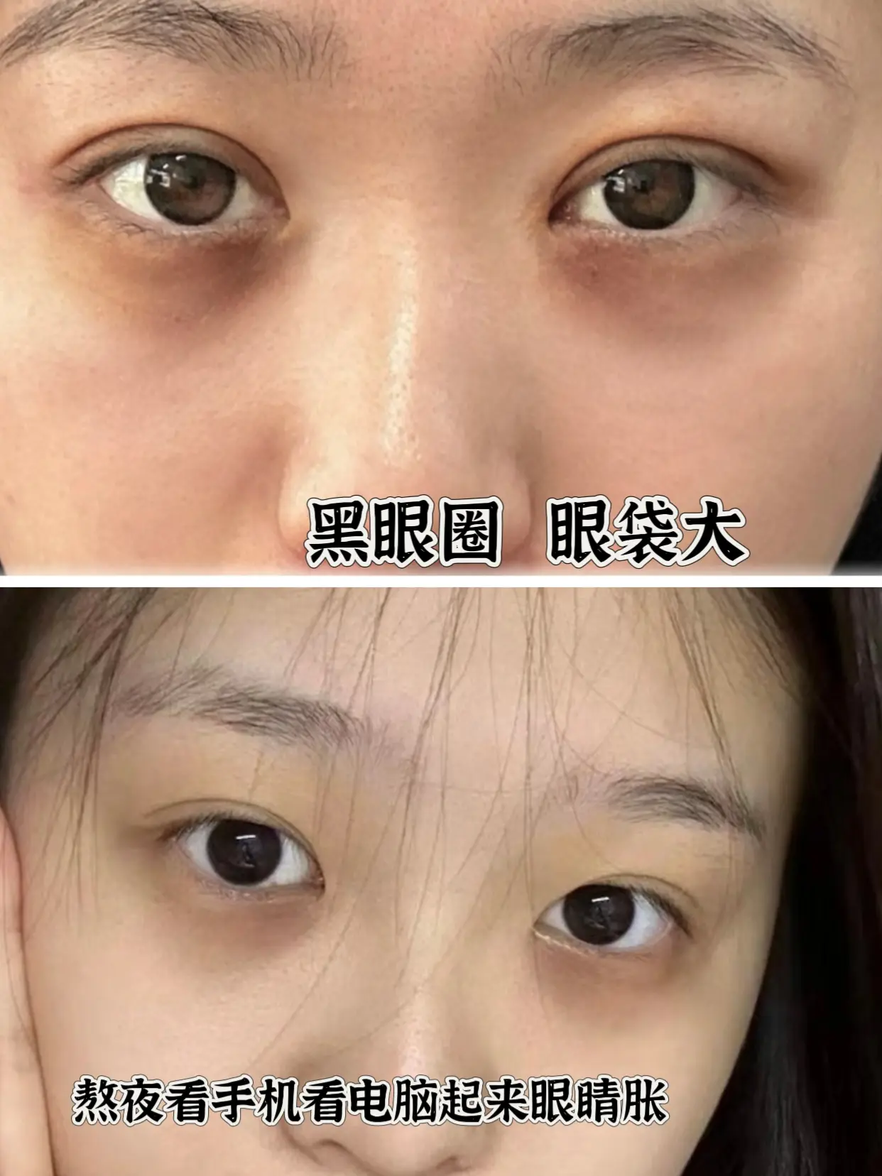 淡化黑眼圈眼袋眼纹。姐妹们现在都用眼膜贴淡化黑眼圈眼袋眼纹，简单方便