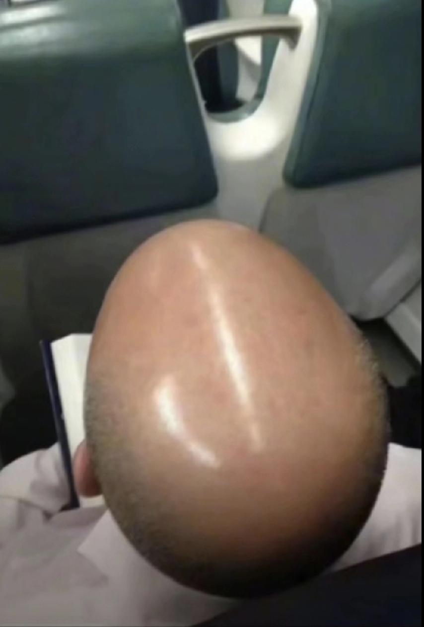 电灯泡亮的发光，这一刻具象化了！