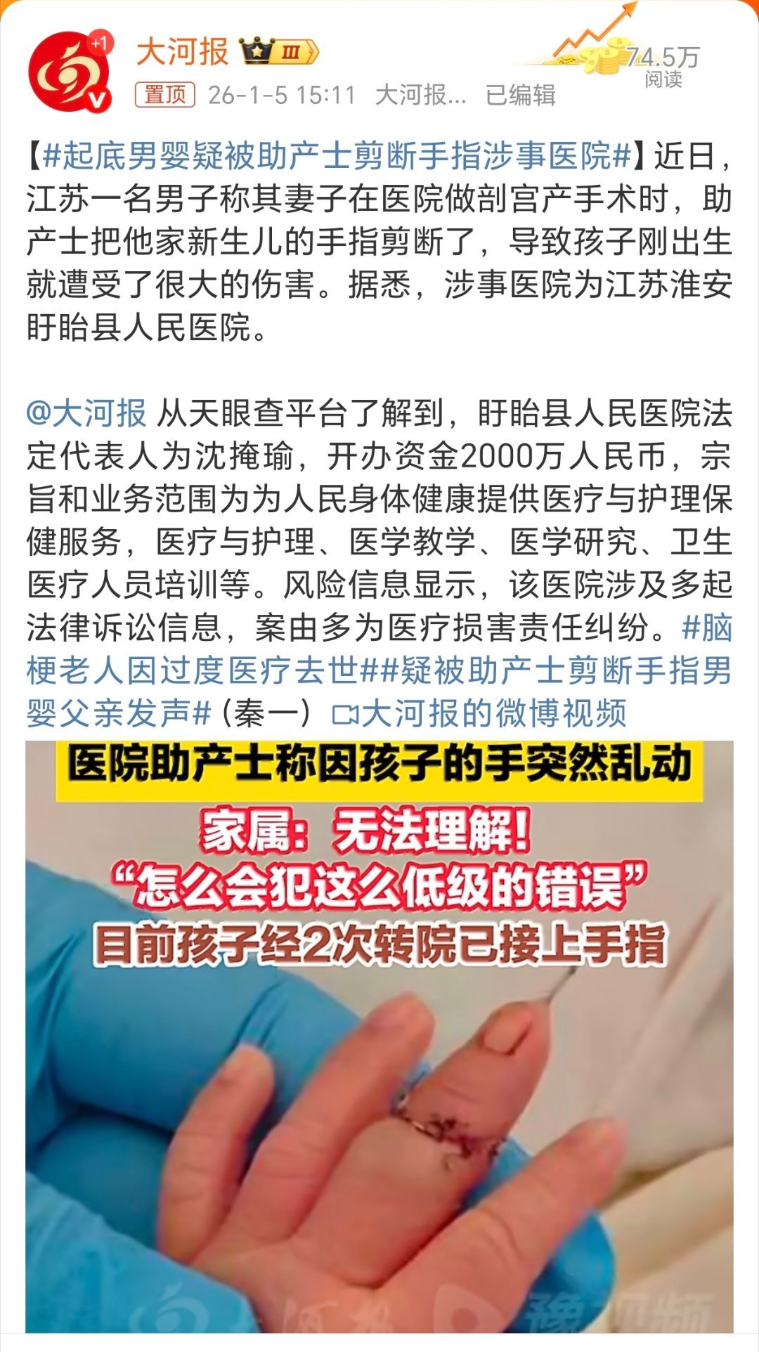 助产士疑剪断男婴手指医院涉多起医疗纠纷心疼男婴！ 