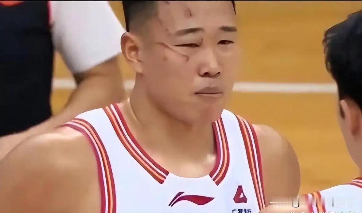 本赛季他的脸被防守球员抓的满脸伤痕累累，都没有骂过人，就算沈梓捷在球场上给他吵翻