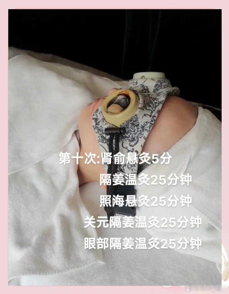 《黄帝内经·灵枢·经筋》记载："太阳为目上纲，阳明为目下纲……灸之则阳气通，目得