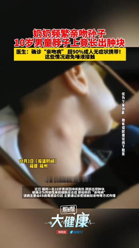 悲剧还是发生了！近日，福建福州，一老人总是亲吻孙子，结果孩子突然发起高烧，脖子上