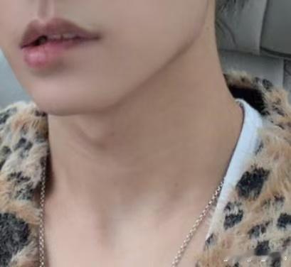 张子墨 馍馍喉结上是有颗痣吗 我不行了吧好事多墨为张子墨守护星愿