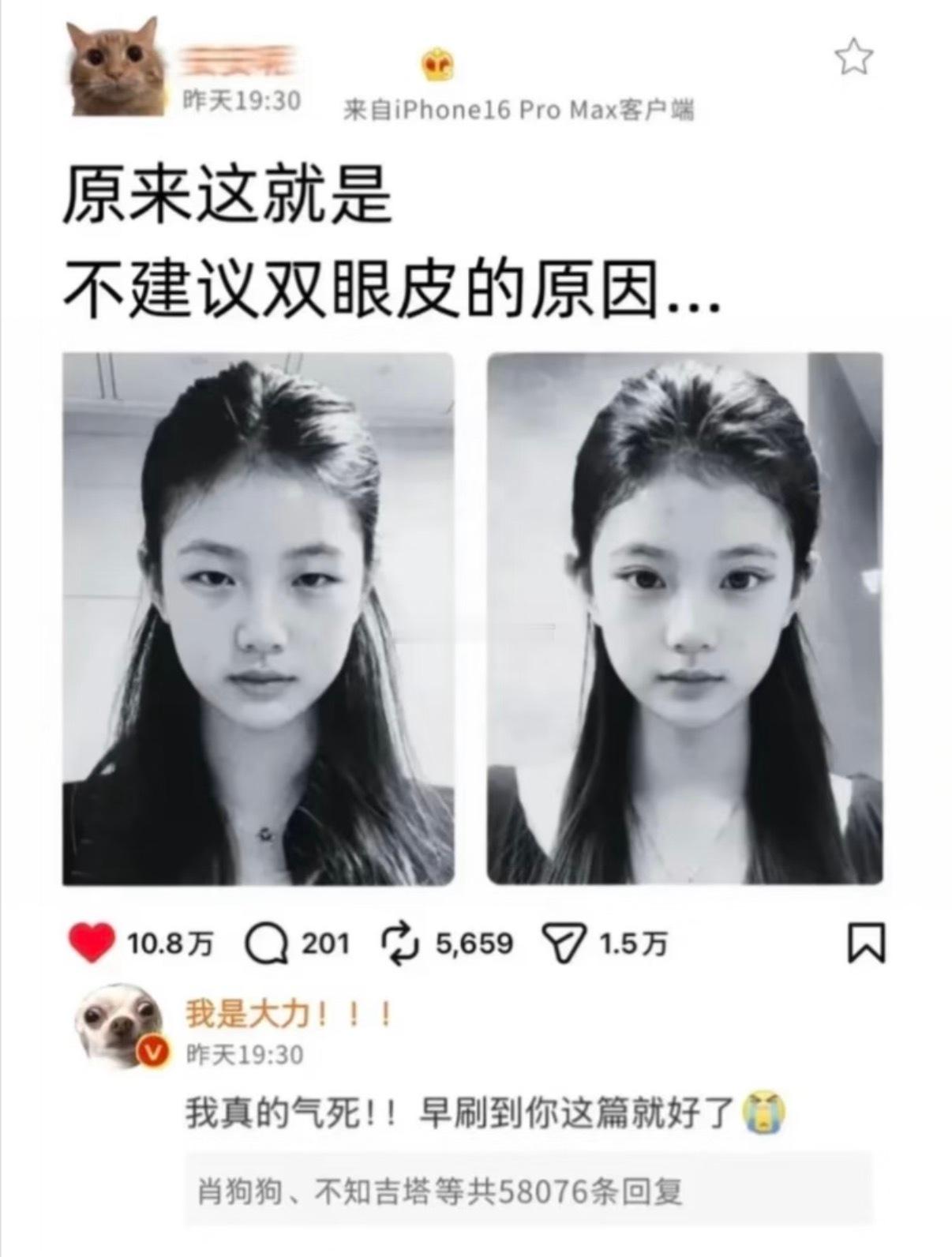 劝醒每一个冲动去割双眼皮的人！！！ ​​​