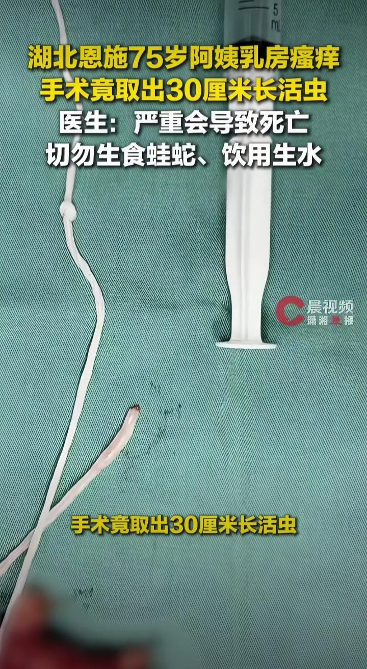 刷到个新闻，看得人头皮发麻，一位大妈的乳房里，竟生活着一条20几厘米的长虫！

