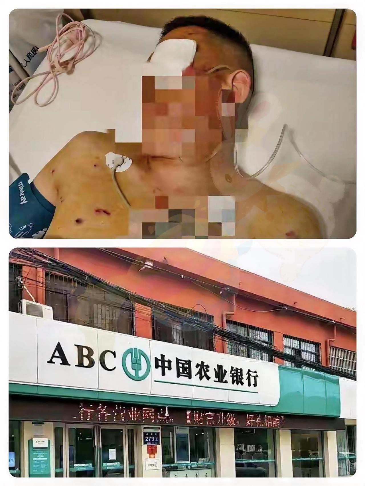 170万现金遭抢致左眼失明！银行门口生死20分钟，保安冷眼旁观？
 
预约取现1