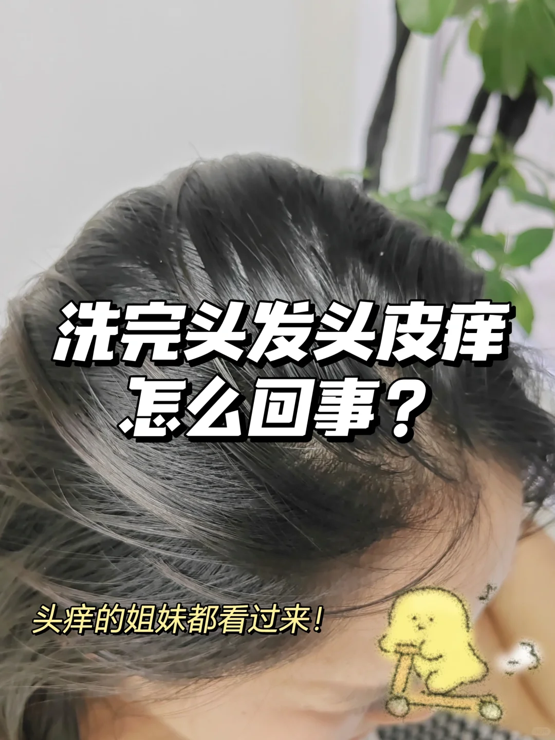洗完头发头皮痒怎么回事？那是洗发水没用对