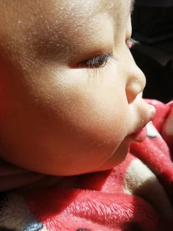 坐标天津南开，我朋友刚生一个孩子，孩子各个方面都挺好，就是一点孩子的半边脸皮肤黑