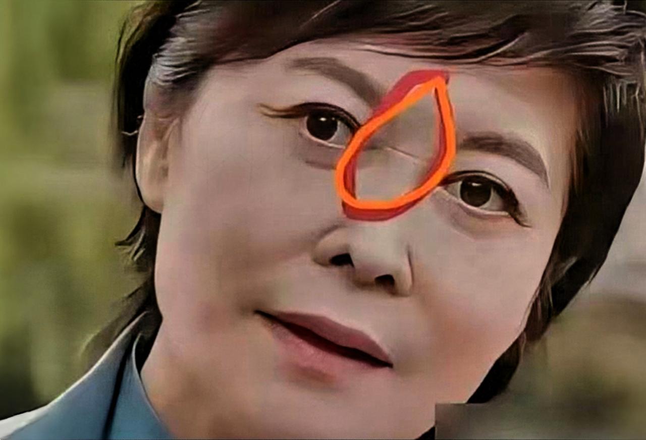 敬一丹鼻梁一道纹被传心脏病！这届网友的养生焦虑，该歇歇了 
 
一张照片传到网上