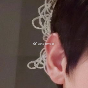 丝瓜汤做法（清爽快手，10分钟搞定）1. 丝瓜去皮切滚刀块，蒜切片，鸡蛋打散备用