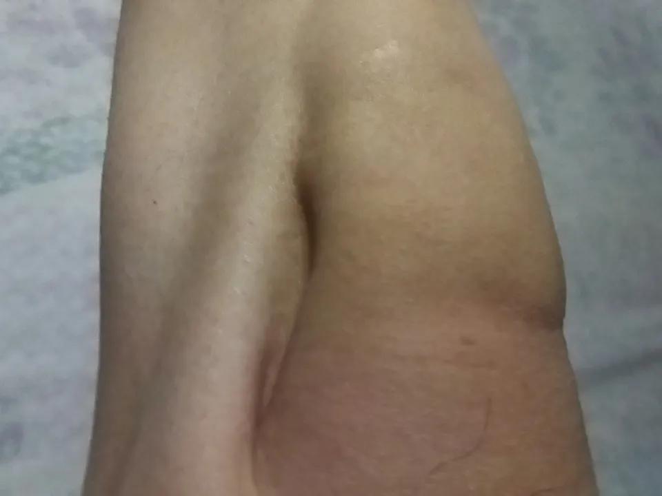 最近膝盖总是不舒服，感觉一点劲都没有，网上查了查说是支撑膝盖的肌肉没力量，需要做
