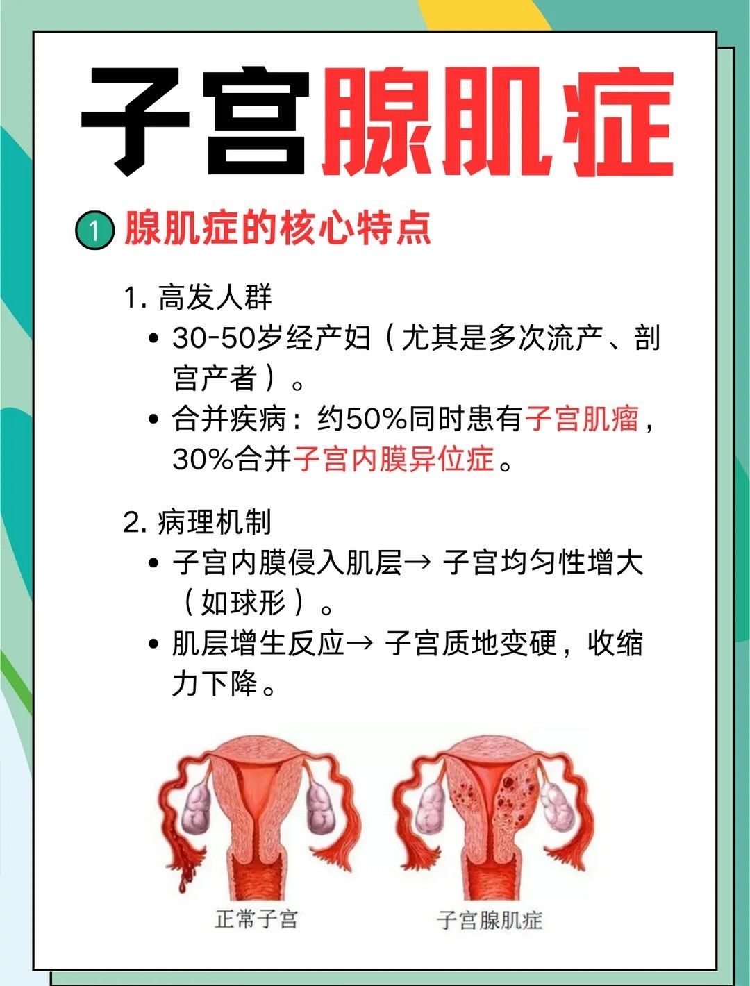 经期3个表现警惕子宫腺肌症 痛经进行性加重、月经量明显增多、经期持续延长，出现这