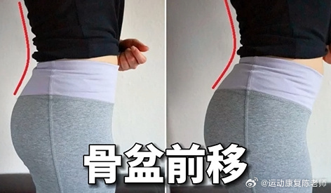 骨盆矫正 【呼吸训练与骨盆前移】不胖但小腹突出，而且经常伴随腰痛和胸闷气短，你这