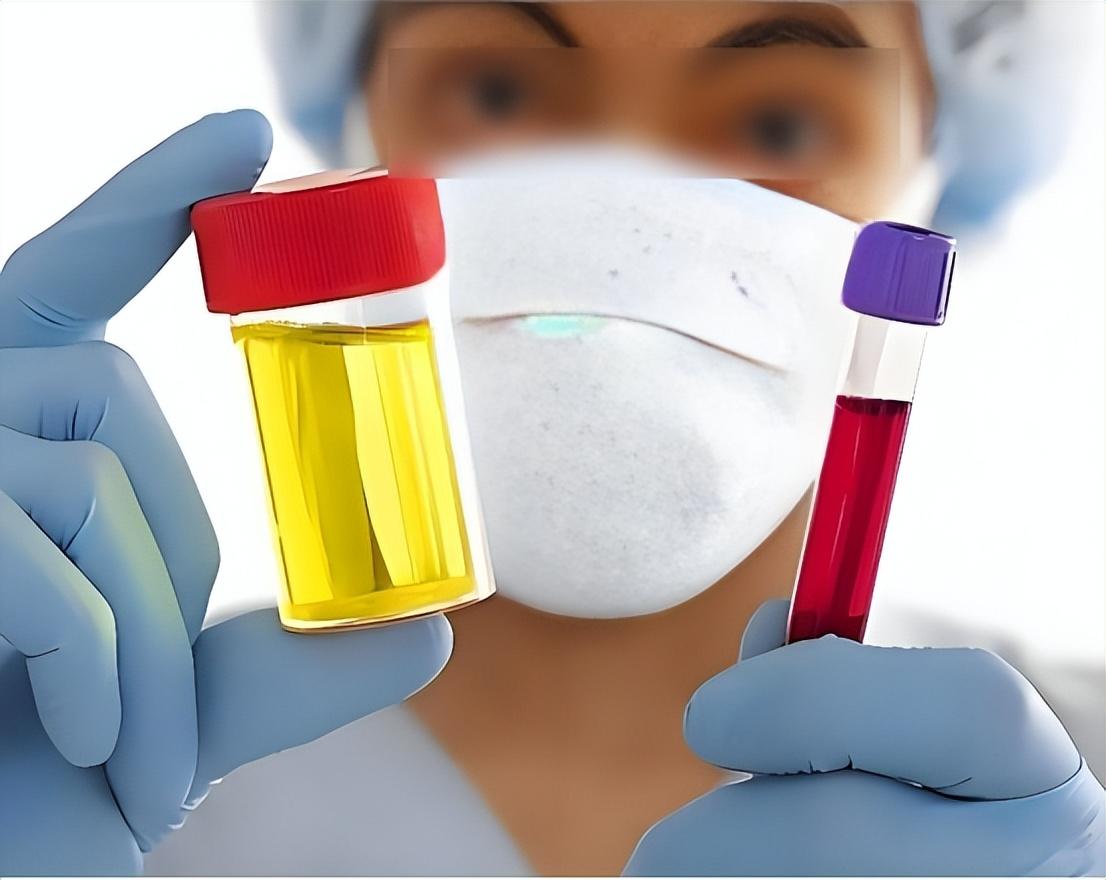 医生：肾开始衰竭的信号，很多人都没放心上，喝水后可能就知道？
喝水后尿量没变化，