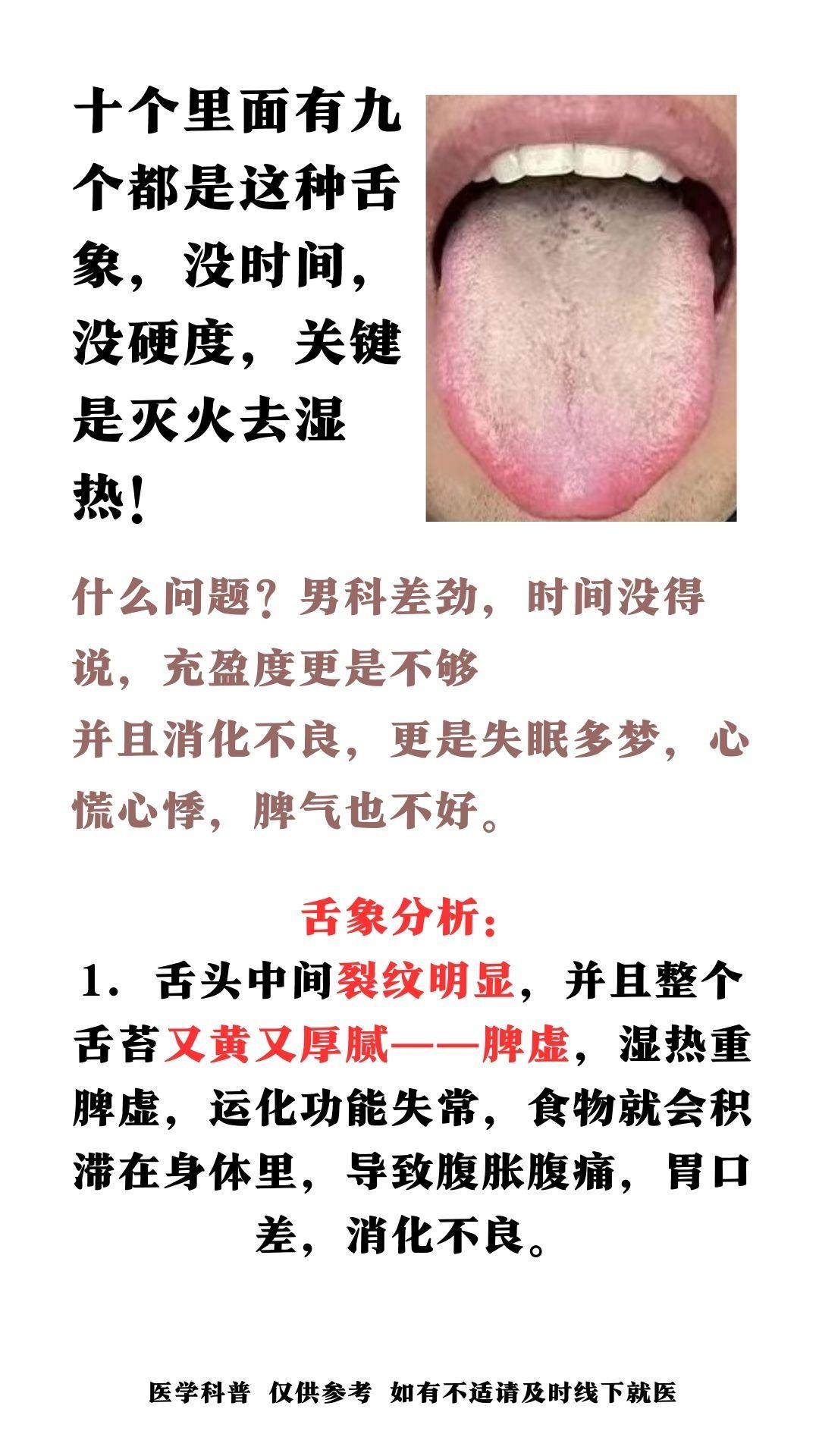 十个里面有九个都是这种舌象，没时间，没硬度，关键是灭火去湿热！#健康科普##舌诊
