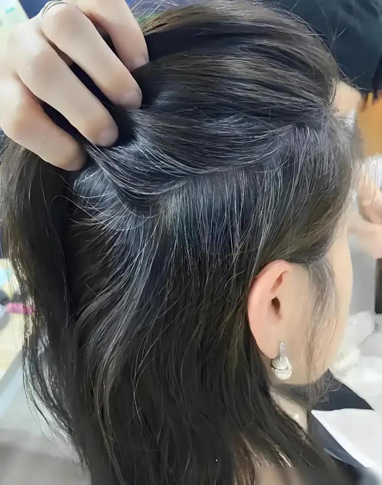 谁能想到，治好我“衰老焦虑”的特效药，竟然是老同学那一头比我更惨的白发。

四十