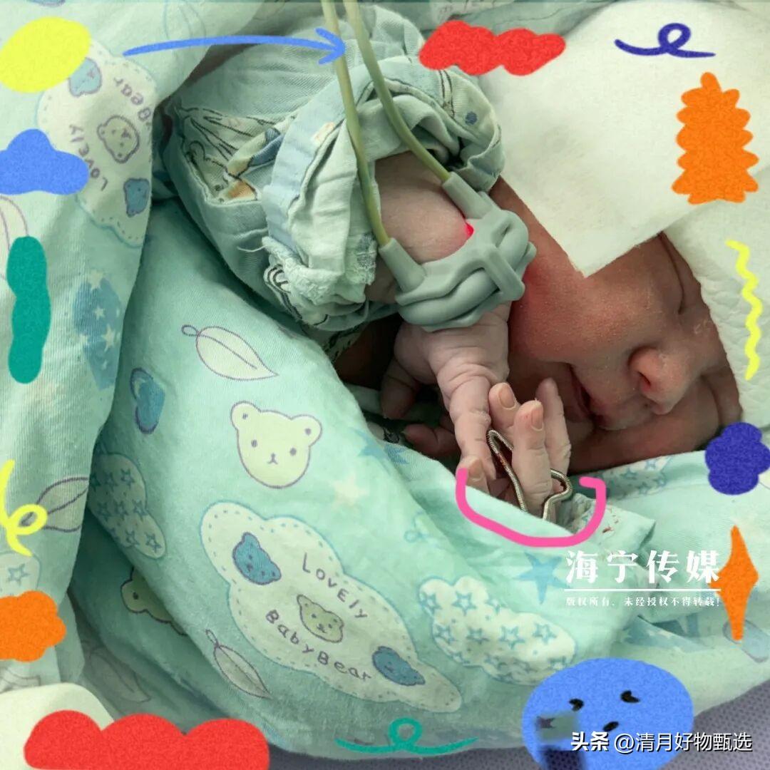 海宁一位妈妈生下“天选女宝”！医生：太罕见了！

“天选女宝”——这四个字，像一