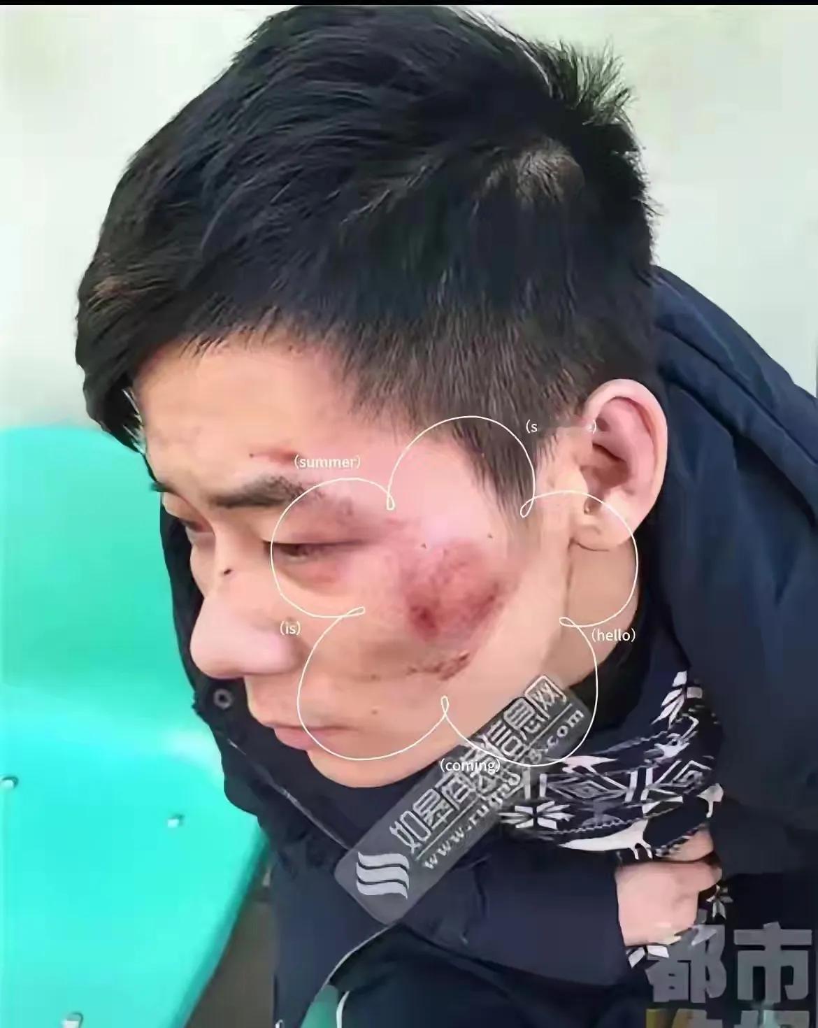 这位大哥可说是演驿了一段最为经典“紧级避险”，教科书式自救…
这天晚上，这男子打