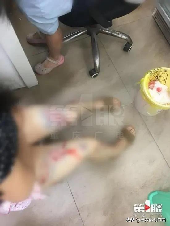 焦作女子被流浪狗咬伤，3天后恶犬暴毙，狂犬阳性的背后藏着多少保命常识
 
河南焦