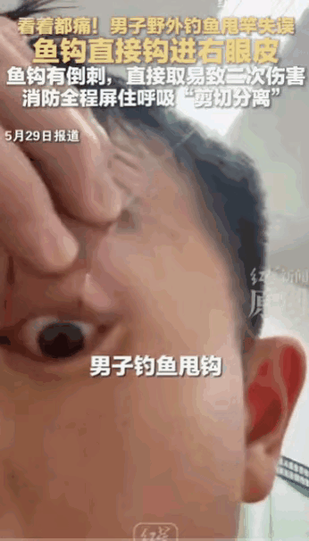“看着都疼！”云南楚雄，一名男子在享受野外垂钓的惬意时光，潇洒甩竿的瞬间，竟乐极