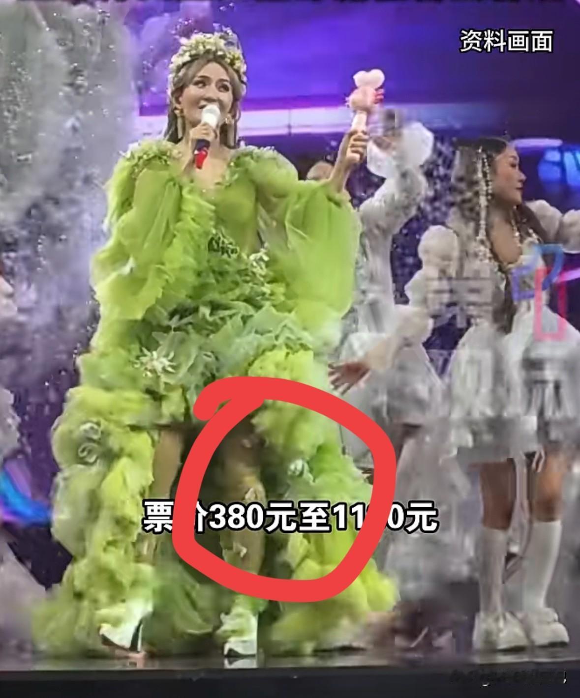 谢娜这套衣服太拉低晚会档次了，当谢娜站直身体，腿部不弯曲，这个丝袜在膝盖部位就会
