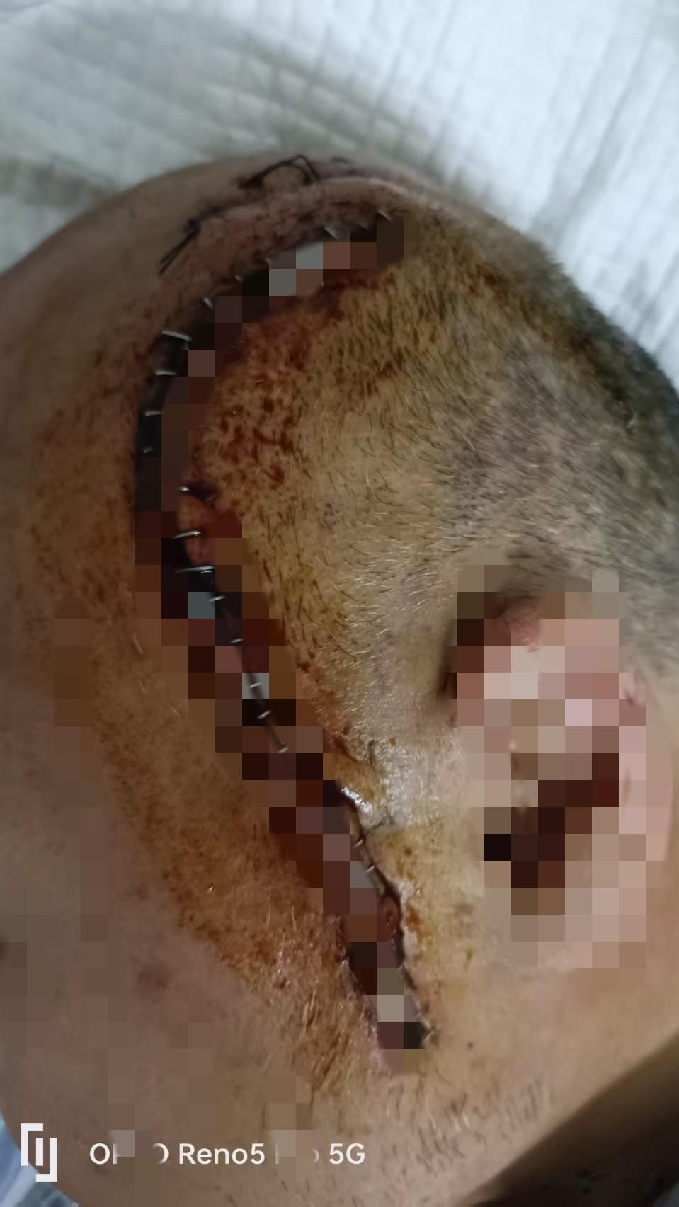 有限生命，如何活得有意义
        生命本就有期限，正是因为有限，每一寸时